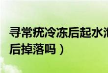 尋常疣冷凍后起水泡需要刺破嗎（尋常疣冷凍后掉落嗎）