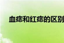 血痣和紅痣的區(qū)別（血痣和紅痣的區(qū)別）