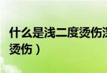 什么是淺二度燙傷深二度燙傷（什么是淺二度燙傷）
