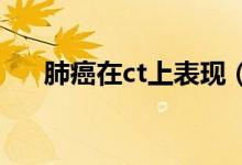 肺癌在ct上表現(xiàn)（肺癌在CT上的表現(xiàn)）