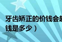牙齒矯正的價錢會越來越貴嗎（牙齒矯正的價錢是多少）