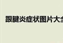 跟腱炎癥狀圖片大全（跟腱炎癥狀有哪些）