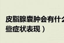 皮脂腺囊腫會(huì)有什么癥狀（皮脂腺囊腫會(huì)有哪些癥狀表現(xiàn)）