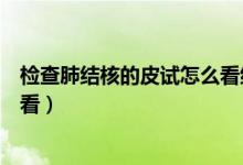 檢查肺結(jié)核的皮試怎么看結(jié)果（肺結(jié)核做皮試正常結(jié)果怎么看）