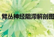 臂叢神經(jīng)阻滯解剖圖（臂叢神經(jīng)阻滯怎么辦）