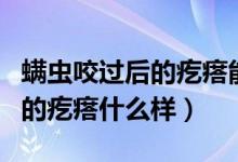 螨蟲咬過后的疙瘩能否自己消退（螨蟲咬過后的疙瘩什么樣）