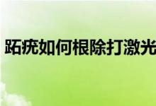 跖疣如何根除打激光多少錢（趾疣如何根除）