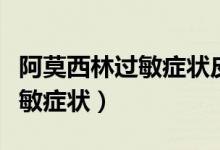 阿莫西林過(guò)敏癥狀皮疹如何止癢（阿莫西林過(guò)敏癥狀）