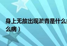 身上無故出現(xiàn)淤青是什么病的前兆（身上無故出現(xiàn)淤青是什么?。?class=