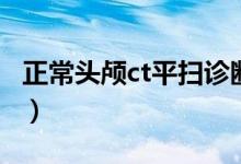 正常頭顱ct平掃診斷報(bào)告（正常頭顱ct多少錢）