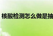 核酸檢測(cè)怎么做是抽血嗎（需要怎么做檢測(cè)）