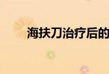 海扶刀治療后的危害（海扶刀危害）