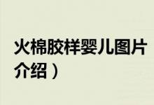 火棉膠樣嬰兒圖片（關(guān)于火棉膠樣嬰兒圖片的介紹）