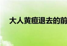 大人黃疸退去的前兆（黃疸退去的前兆）