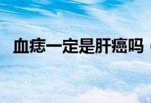 血痣一定是肝癌嗎（有血痣一定是肝癌嗎）