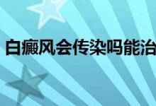 白癜風(fēng)會(huì)傳染嗎能治好嗎（白癜風(fēng)會(huì)傳染嗎）