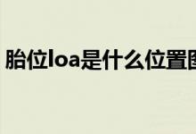 胎位loa是什么位置圖（胎位loa是什么位置）
