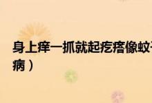 身上癢一抓就起疙瘩像蚊子咬（身上癢一抓就起疙瘩是什么?。?class=