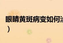 眼睛黃斑病變?nèi)绾沃委煟ㄑ劬τ悬S斑怎么治療）