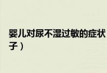 嬰兒對尿不濕過敏的癥狀（寶寶帶尿不濕過敏癥狀是什么樣子）