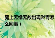 腿上無(wú)緣無(wú)故出現(xiàn)淤青怎么治療（腿上無(wú)緣無(wú)故出現(xiàn)淤青怎么回事）