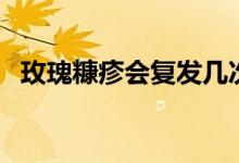 玫瑰糠疹會(huì)復(fù)發(fā)幾次（玫瑰糠疹會(huì)復(fù)發(fā)嗎）