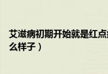 艾滋病初期開始就是紅點癥狀嗎（艾滋病癥狀初期紅點是什么樣子）