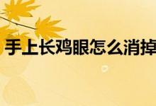 手上長(zhǎng)雞眼怎么消掉（手上長(zhǎng)雞眼怎么消除）