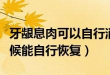 牙齦息肉可以自行消退嗎（牙齦有息肉什么時候能自行恢復(fù)）