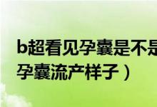 b超看見孕囊是不是就可以流產(chǎn)了（一個(gè)月的孕囊流產(chǎn)樣子）