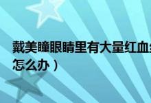戴美瞳眼睛里有大量紅血絲怎么辦（戴美瞳眼球周圍紅血絲怎么辦）