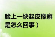 臉上一塊起皮像癬（臉上一塊一塊的起皮像癬是怎么回事）