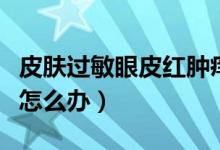 皮膚過敏眼皮紅腫癢怎么辦（眼皮過敏紅腫癢怎么辦）