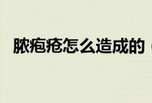 膿皰瘡怎么造成的（膿皰瘡是怎么引起的）