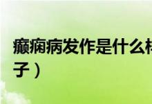 癲癇病發(fā)作是什么樣子（癲癇病發(fā)作是什么樣子）
