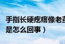 手指長硬疙瘩像老繭（手指長了個(gè)硬疙瘩像繭是怎么回事）
