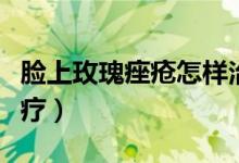 臉上玫瑰痤瘡怎樣治療（臉上玫瑰痤瘡怎么治療）