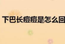 下巴長痘痘是怎么回事（下巴長痘痘的原因）