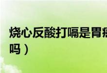 燒心反酸打嗝是胃癌嗎（打嗝燒心反酸是胃癌嗎）