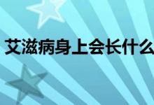 艾滋病身上會(huì)長(zhǎng)什么（艾滋病身上會(huì)長(zhǎng)什么）
