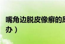 嘴角邊脫皮像癬的原因（嘴角邊脫皮像癬怎么辦）