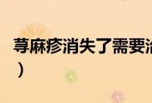 蕁麻疹消失了需要治療嗎（蕁麻疹多久才能好）