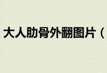 大人肋骨外翻圖片（大人肋骨外翻有危害嗎）
