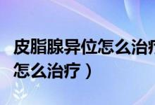 皮脂腺異位怎么治療能上藥膏嗎（皮脂腺異位怎么治療）