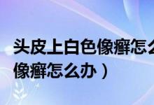 頭皮上白色像癬怎么辦吃什么藥（頭皮上白色像癬怎么辦）