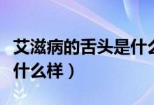 艾滋病的舌頭是什么樣的（艾滋病舌頭兩側(cè)是什么樣）