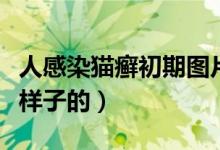 人感染貓癬初期圖片（人感染貓癬初期是什么樣子的）