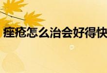 痤瘡怎么治會好得快（痤瘡怎么治會好的快）