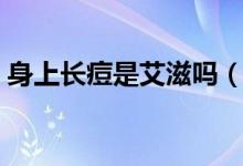 身上長痘是艾滋嗎（身上有痘痘是艾滋病嗎）