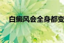 白癜風會全身都變白嗎（白癜風會死嗎）